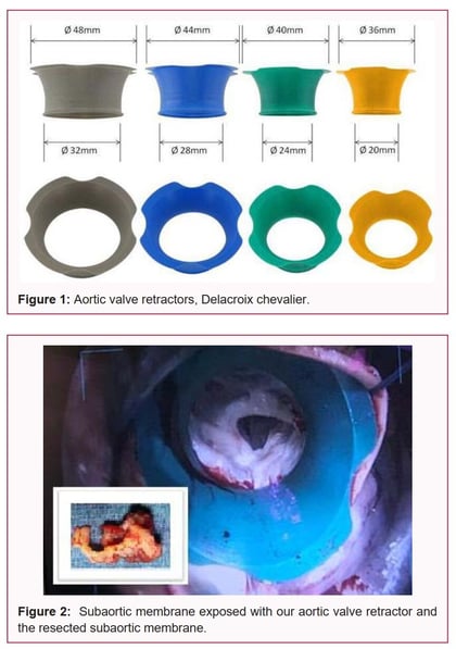 aortic valve retractor